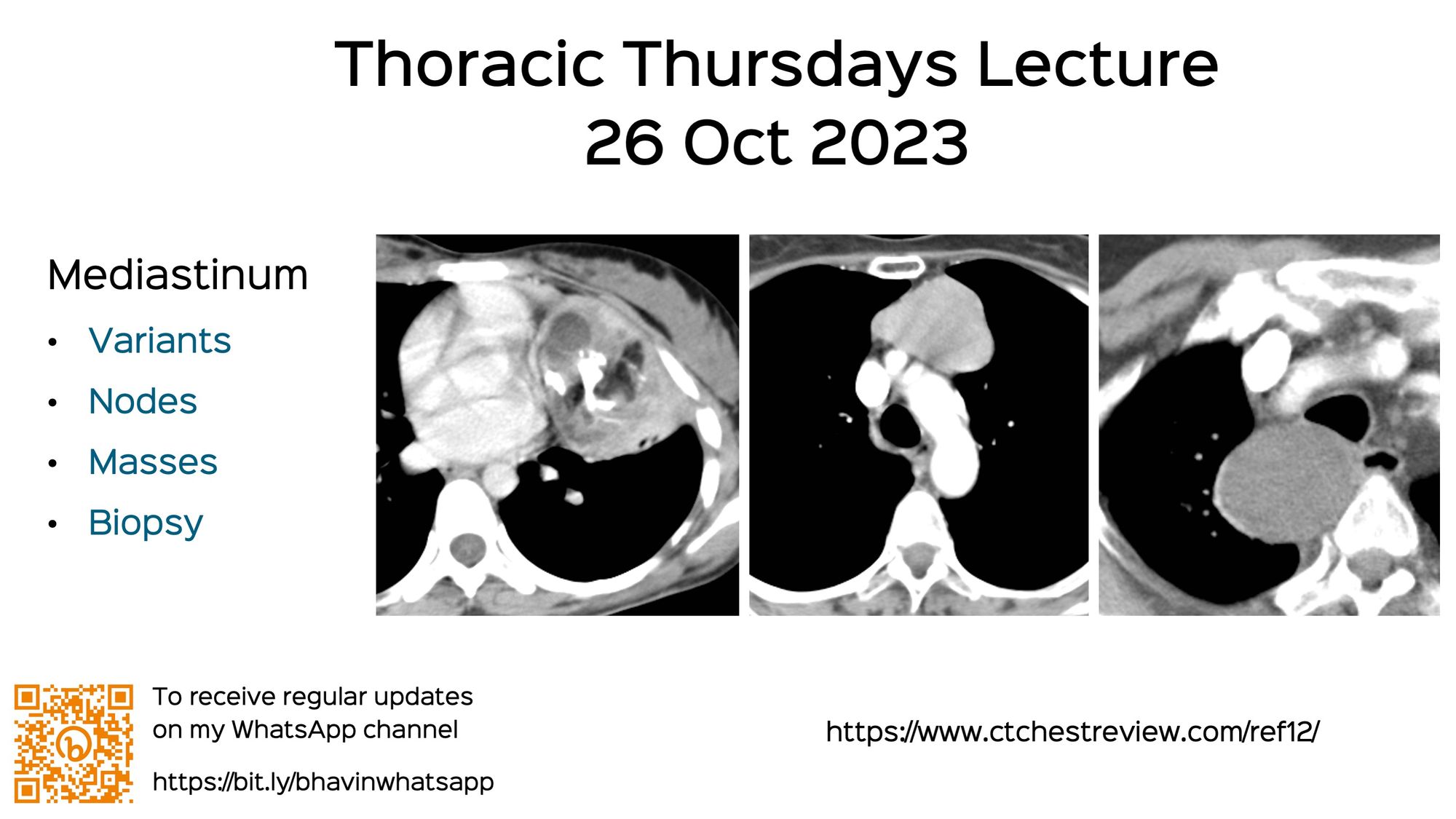REF-Cafe Roentgen Thoracic Thursday Lecture - XII - 26th Oct 2023: Mediastinum