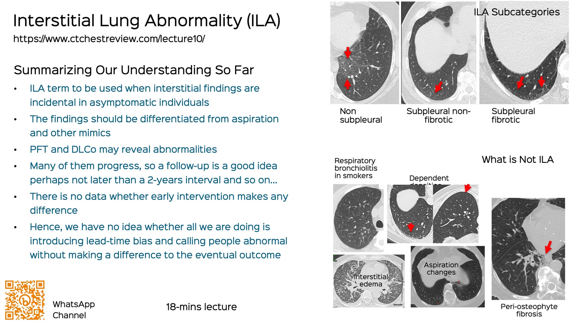 Lecture: How to Approach a Patient with Interstitial Lung Abnormality (ILA)