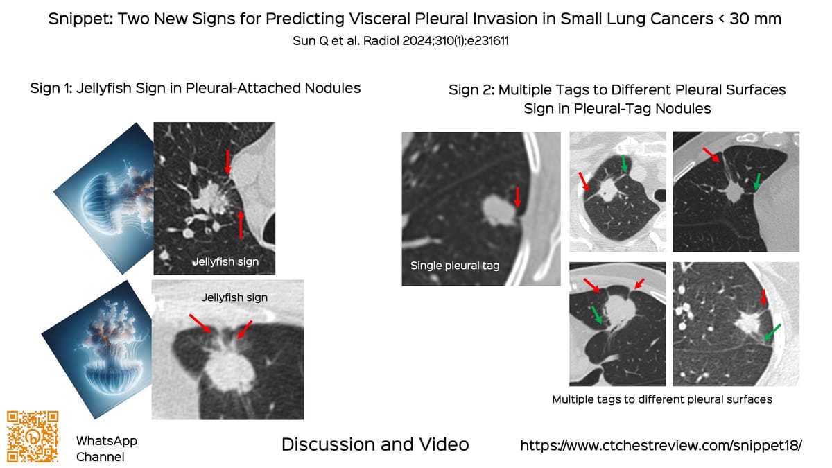 Lecture: Imaging of Sarcoidosis